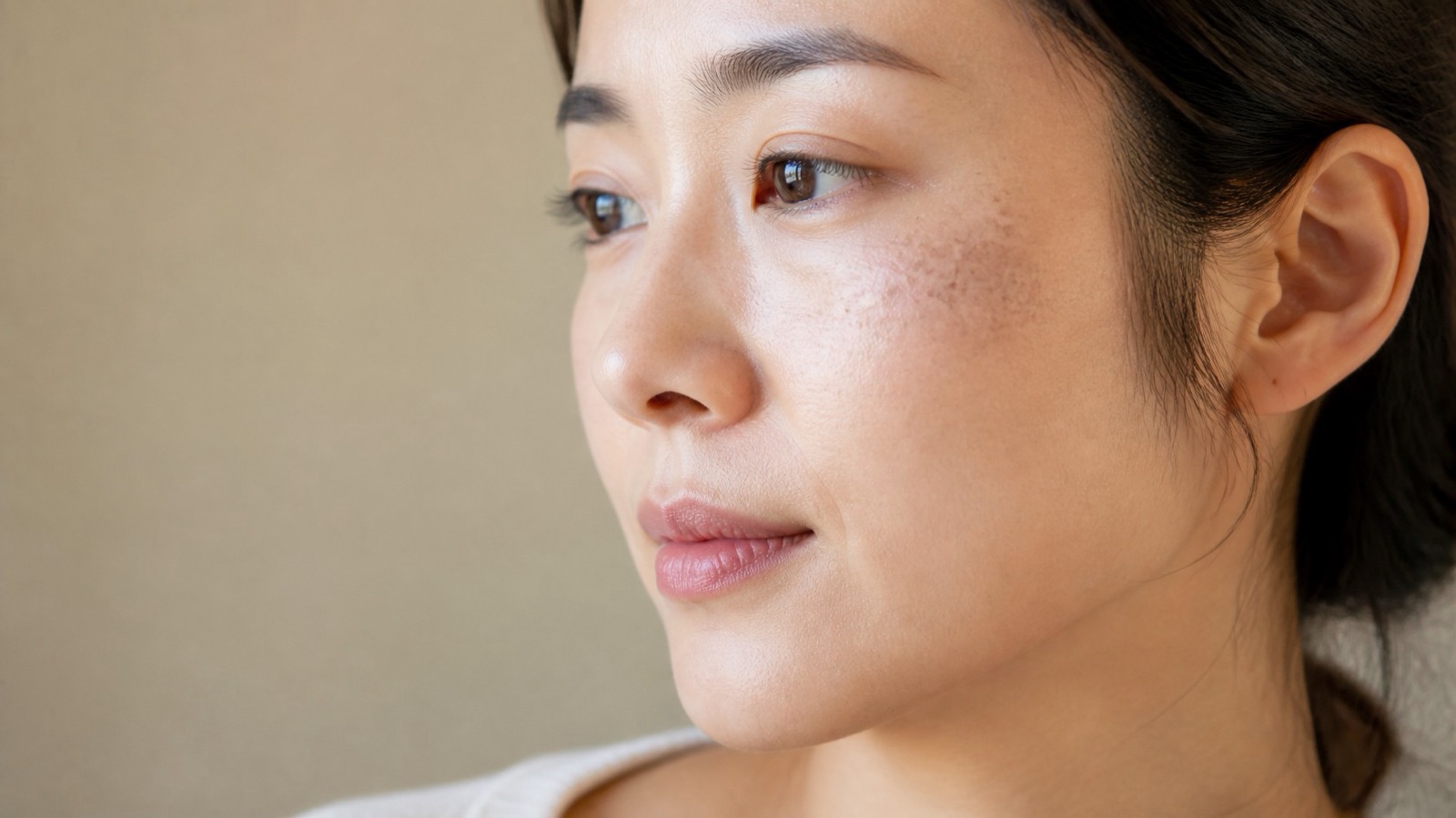 Close-up of a woman's cheek with grey-brown speckled patches on the cheekbone