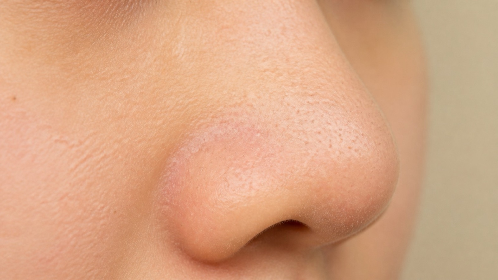 Close-up of the side of a nose showing small dots in the pores