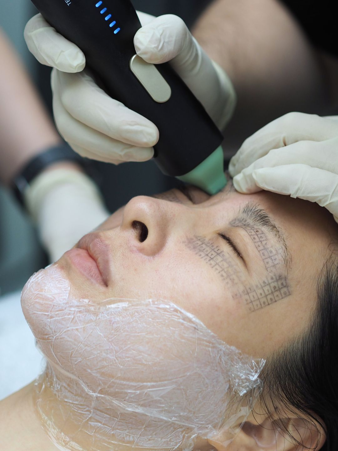 Treatment journey