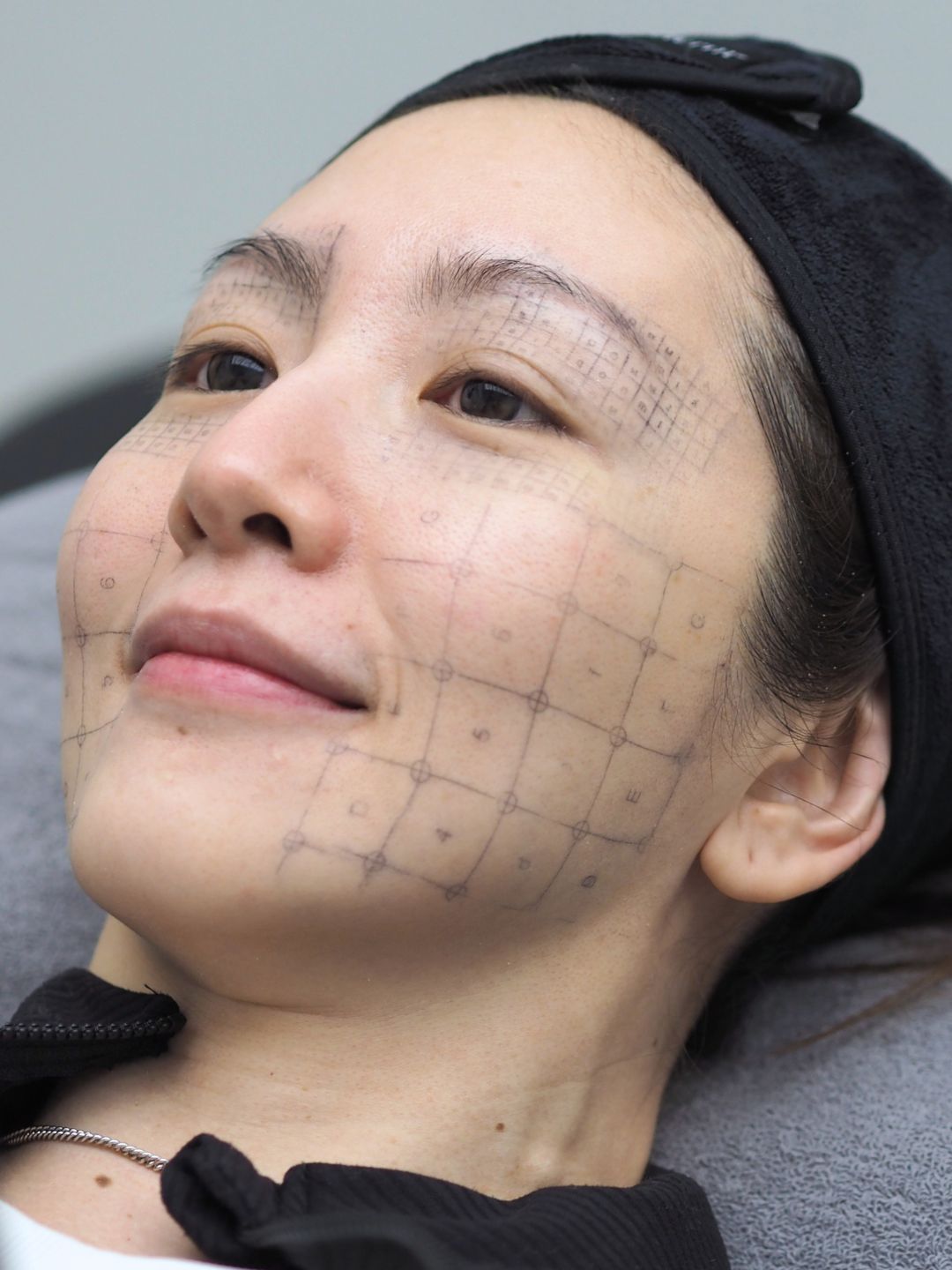 Treatment journey