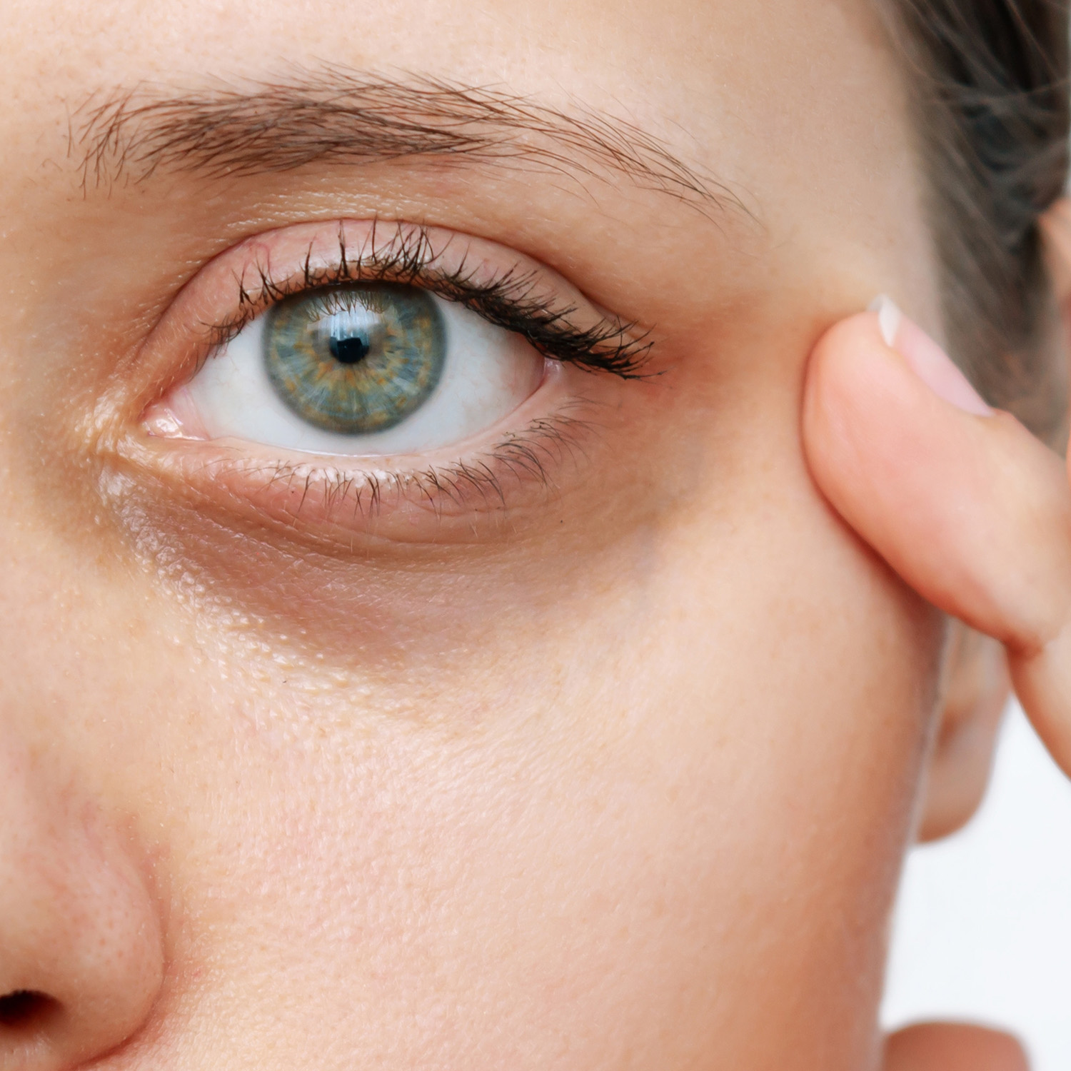 Tired, aged eye appearance