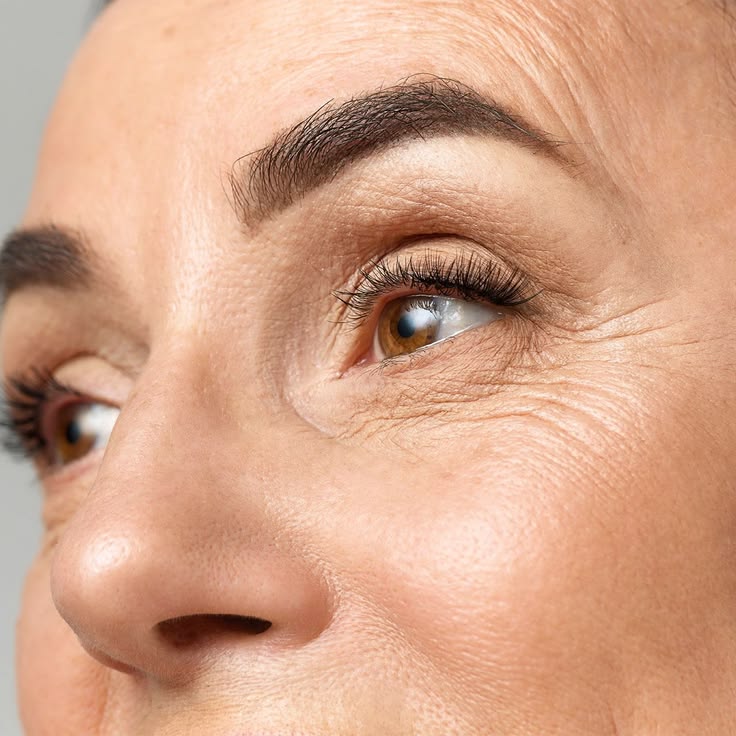 Under-eye crepey skin