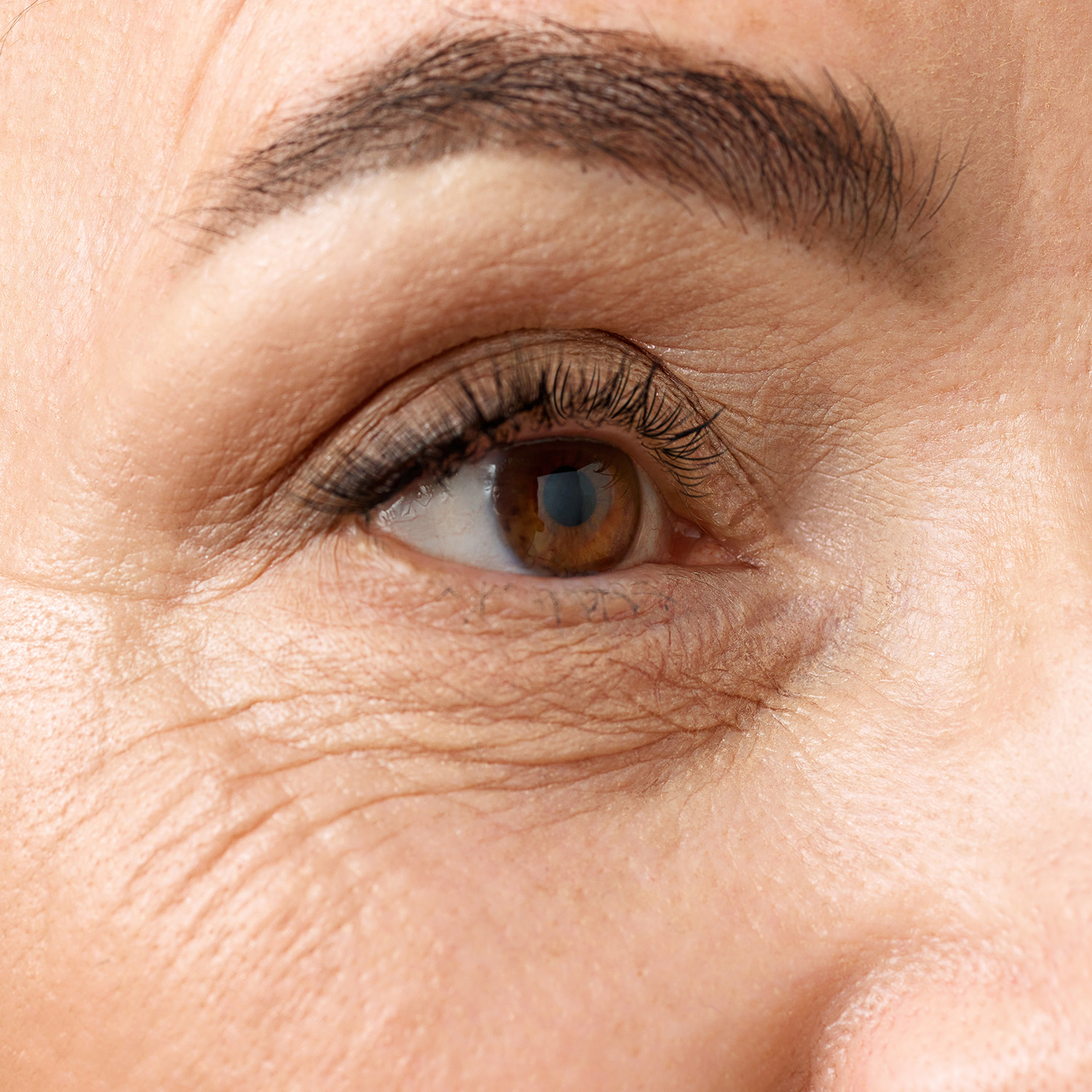 Dynamic Wrinkles