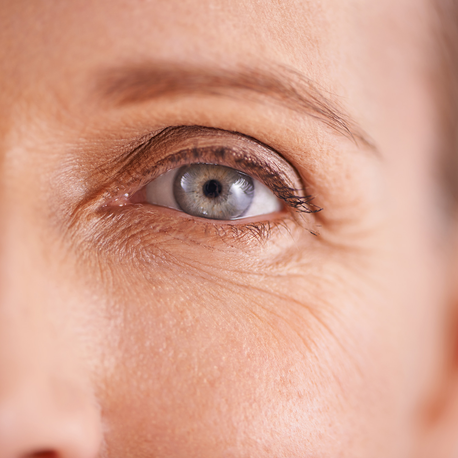 Mild to moderate skin laxity