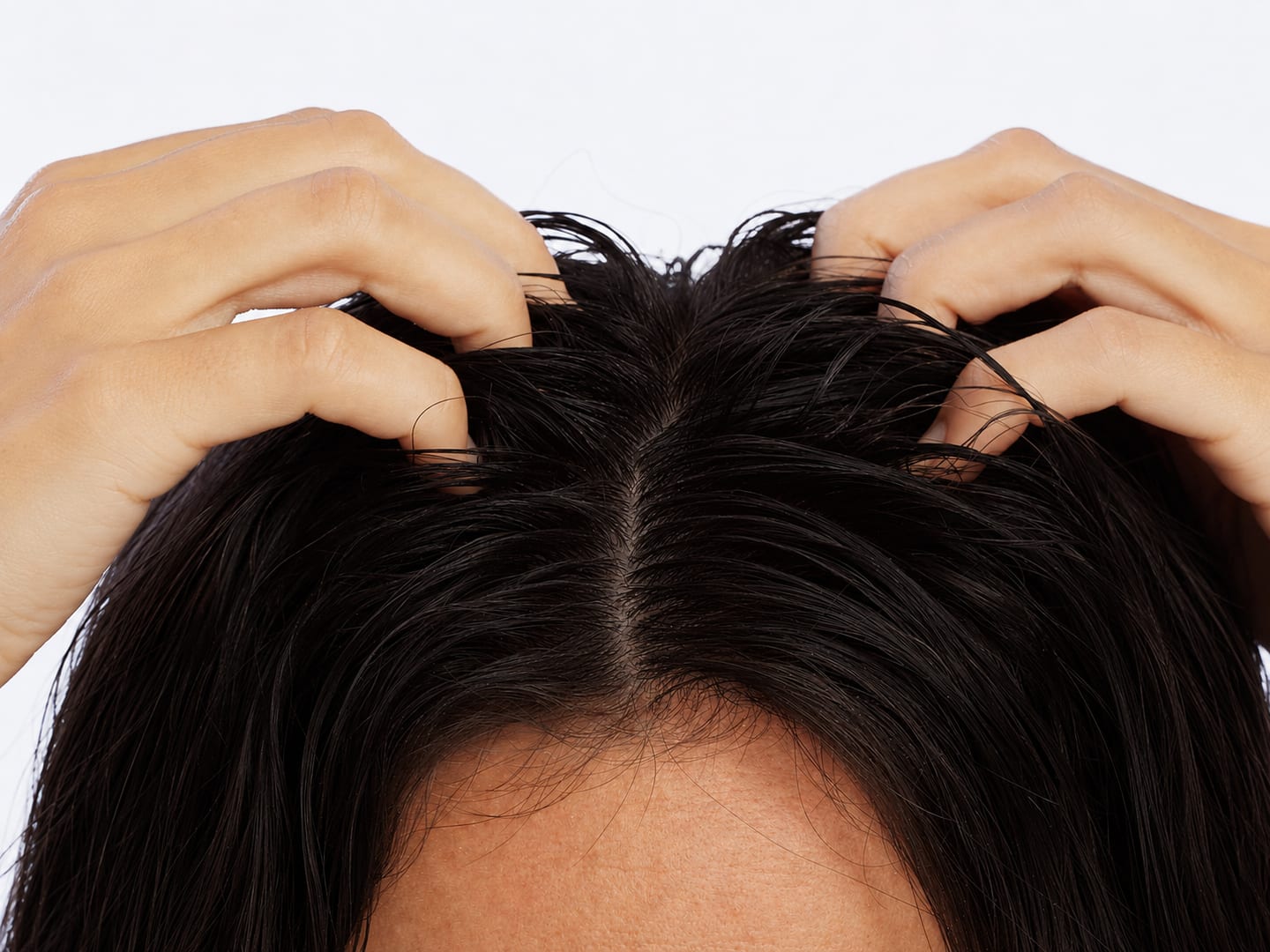 Close-up of a scalp parting showing hair thinning
