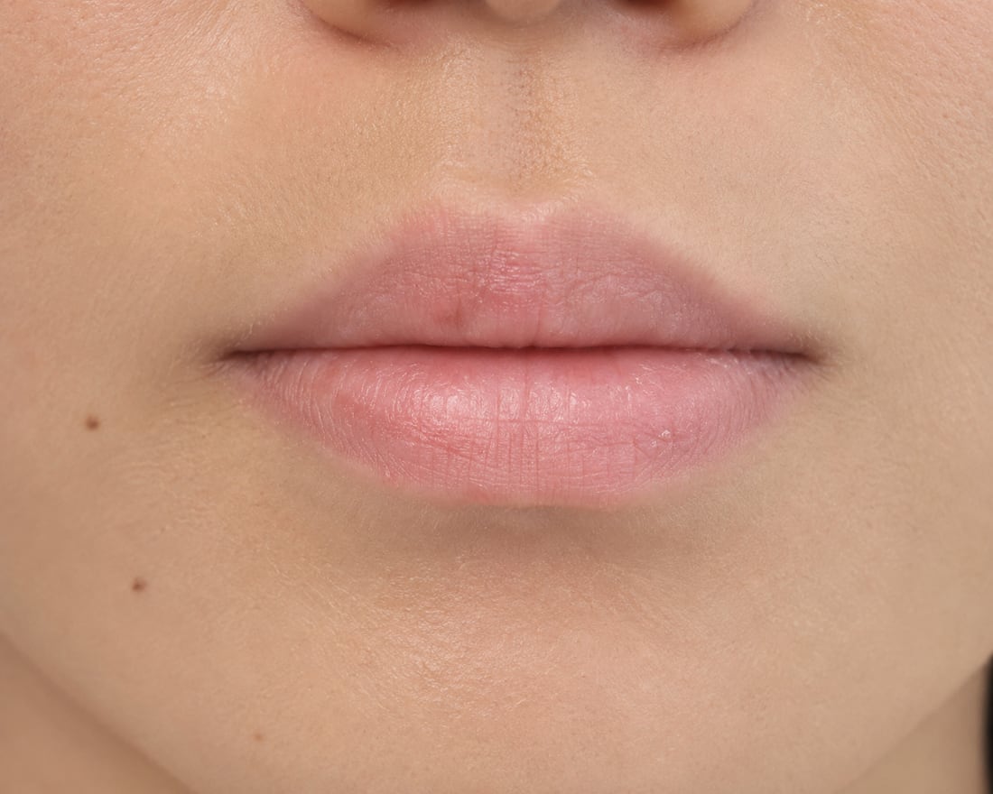 Undefined lip borders