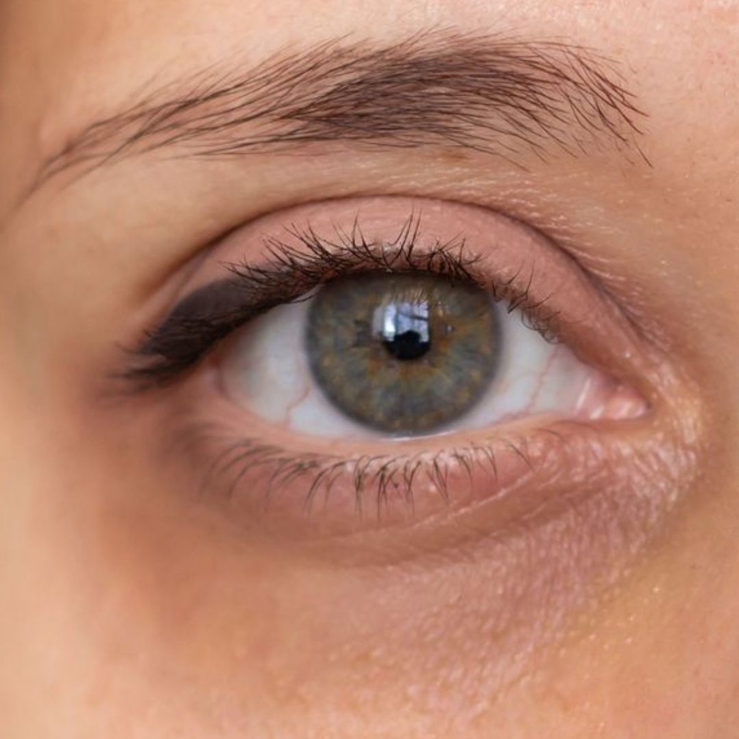 Dark Circles